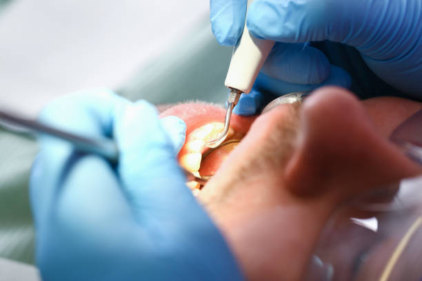 Best Emergency Dental Care for Broken or Chipped Teeth in Lake Hiawatha, NJ
