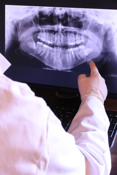 Best Emergency Treatment for Dental Infections or Abscesses in Lake Hiawatha, NJ