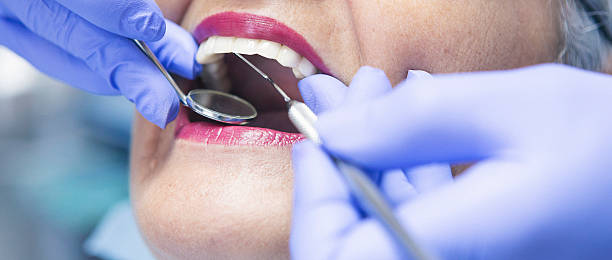 Best Urgent Care for Lost Fillings or Crowns in Lake Hiawatha, NJ